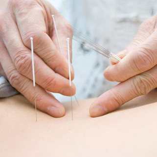 Energiemedizin über Akupunktur